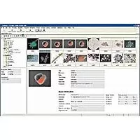 Axio Vision " программное обеспечение Carl Zeiss для обработки и анализа изображения