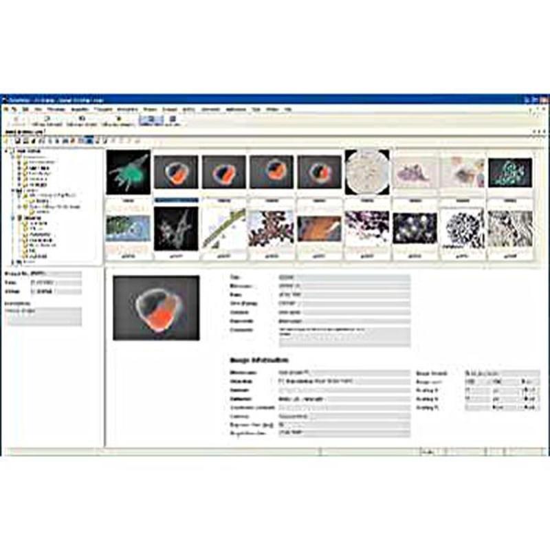 Axio Vision " программное обеспечение Carl Zeiss для обработки и анализа изображения
