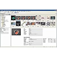 Axio Vision " программное обеспечение Carl Zeiss для обработки и анализа изображения
